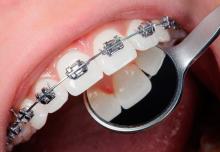 Ортодонтическое отделение