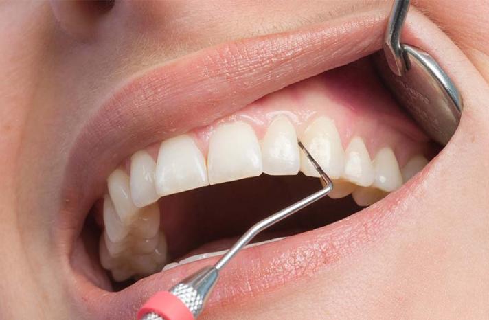 Лечение дёсен в Нашгороде